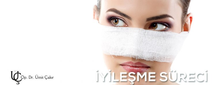 burun estetği sonrası morluk ve şişliklerin iyileşme süreci