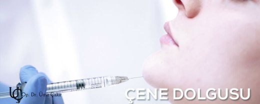 çene dolgusu nasıl yapılır, Bursa'da Ümit Çakır kliniğinde yapılır