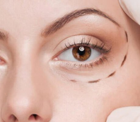 göz altı ışık dolgusu