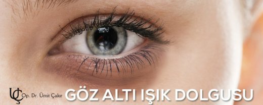 göz altı ışık dolgusu