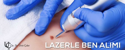 lazerle ben alımı işlemi bursa dr ümit çakır estetik ve güzellik